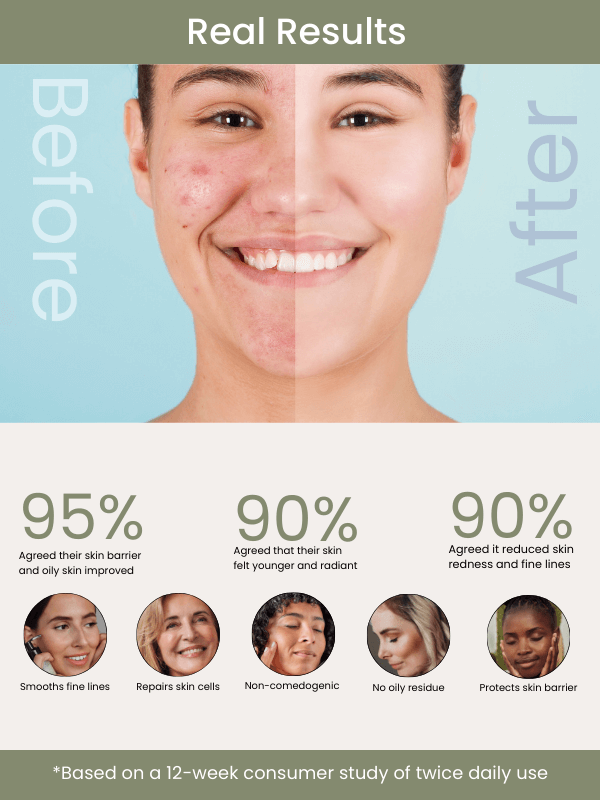 Skin Creamery Facial Hydrating Oil & Restoring Treatment | 30ML